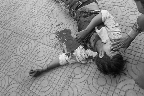 CAMBODIA. Phnom Penh.3/01/2014: Striking worker badly wounded by armed forces gunfire during crackdown of protest at Veng Sreng road.